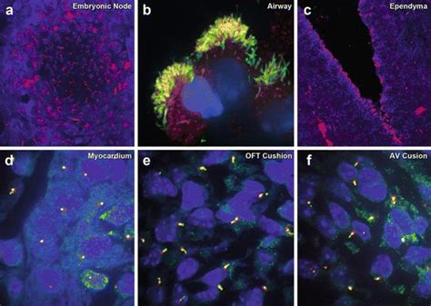 Tubulin In Cilia