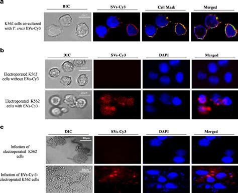 Assessing infection of vesicle-treated K562 cells by fluorescence...