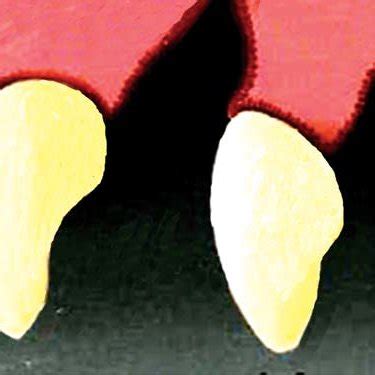 (PDF) Modified Ovate Pontic Design for Immediate Anterior Tooth Replacement
