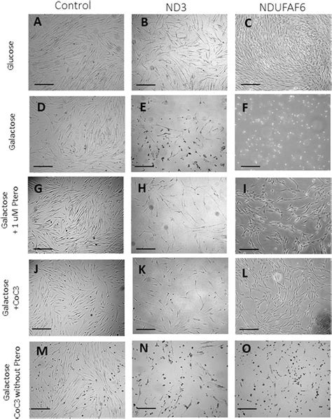 Frontiers Pterostilbene In Combination With Mitochondrial Cofactors