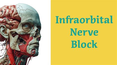 Infraorbital Nerve Block Procedure Youtube