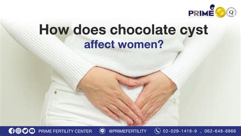 How does chocolate cyst affect women? | ivf bangkok | ICSI