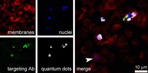 Analysis Of The Delivery Of Immunoliposome Cargo To Prbcs Confocal