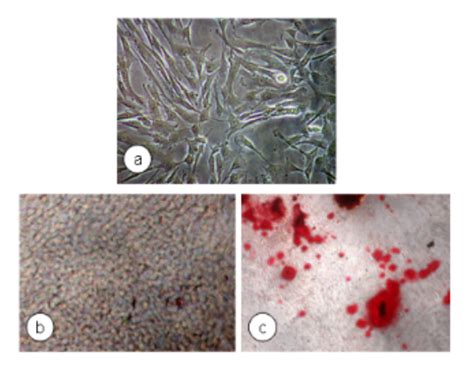 Human dental pulp stem cells (DPSC) differentiation to osteoblast-like ...