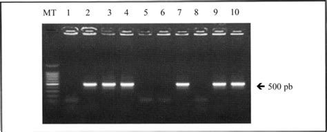 Electrophorese Sur Gel D Agarose Des Produits D Amplification De 500