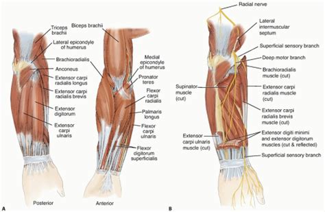 Tendon Transfers for Radial Nerve Palsy | Musculoskeletal Key