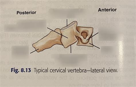 Typical Cervical Vertebra Lateral View Fall 22 Diagram Quizlet