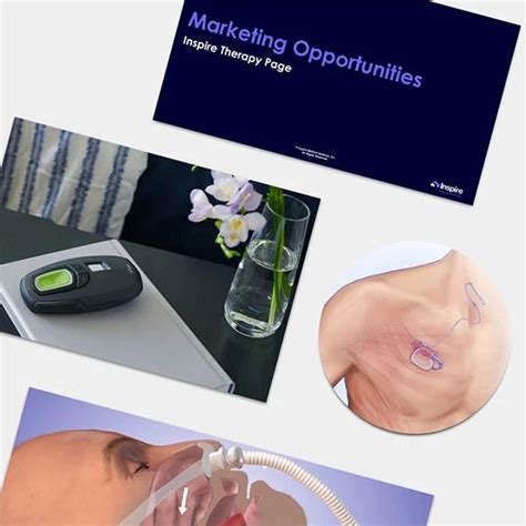 Marketing And Media Kits Inspire Sleep Apnea Innovation