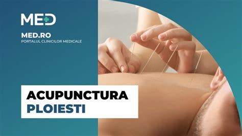 Acupunctura Ploiesti Clinica Verificata Med Ro