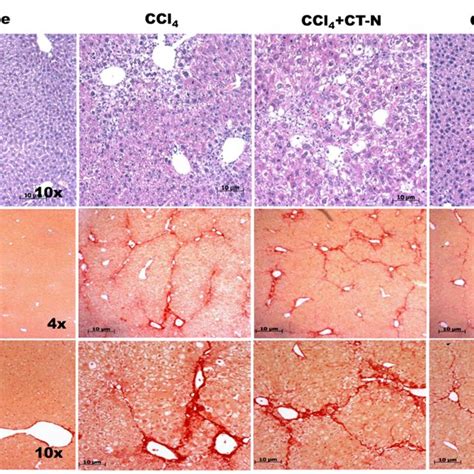 Histological Analysis Of Ccl4 Induced Chronic Liver Injury A