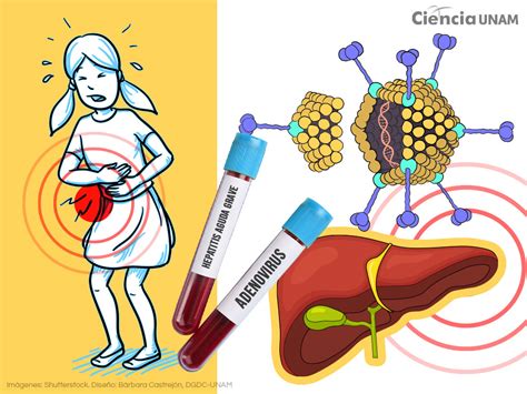 Causas De La Hepatitis A