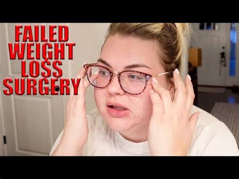 Alexandra Rodriguez Failed Weight Loss Surgery YouTube