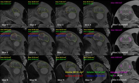 The brain segment result of a chick embryo at 17 days of incubation ... 