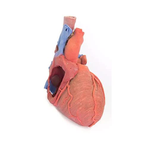 MP1710 Heart and the Distal Trachea,Carina and Primary Bronchi ...