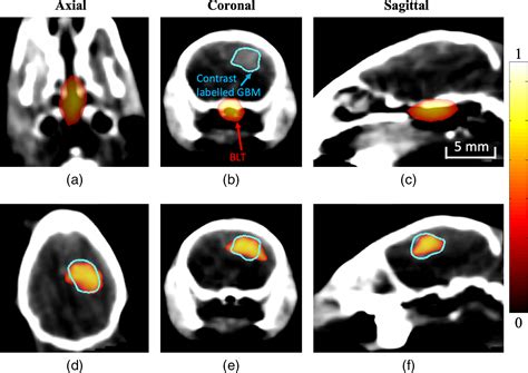 Quantitative Molecular Bioluminescence Tomography