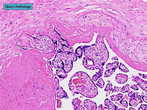 Flickriver Qiao S Pathology Art And Science In Medicine S Photos