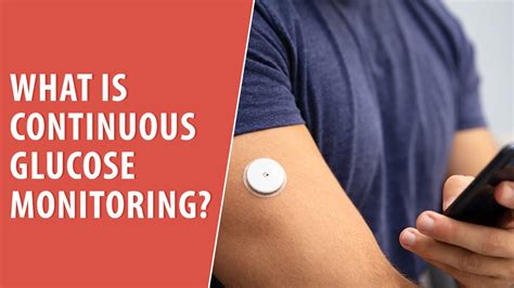 What Is Continuous Glucose Monitoring