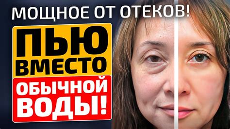 Не могла выйти на улицу, отекало все тело! Раз и навсегда от отеков мне ...