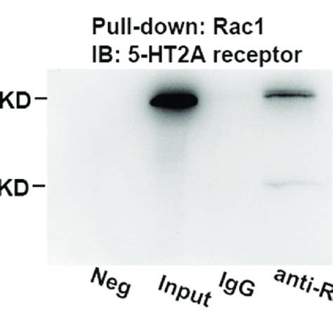 Co Immunoprecipitation Ip Assays Demonstrated The Interactions