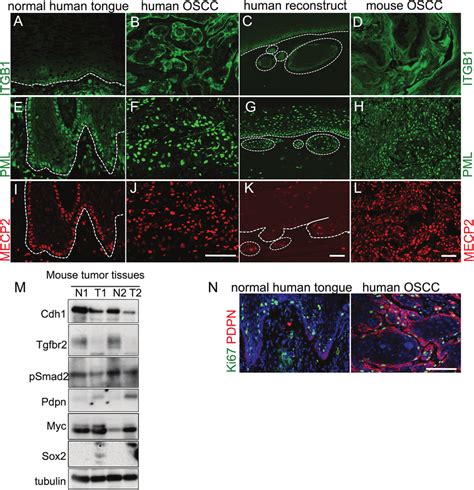 Changes In Putative Stem Cell Marker Expression During Tumor