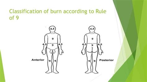 Burns And Scalds Ppt