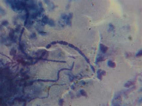 Figure 1 From Identification Of Dermatophilus Congolensis From Lower