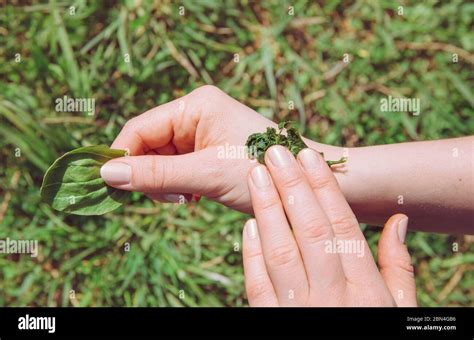 Persona Mano De Retenci N Y Curaci N De La Herida Con Mezcla De Plantas