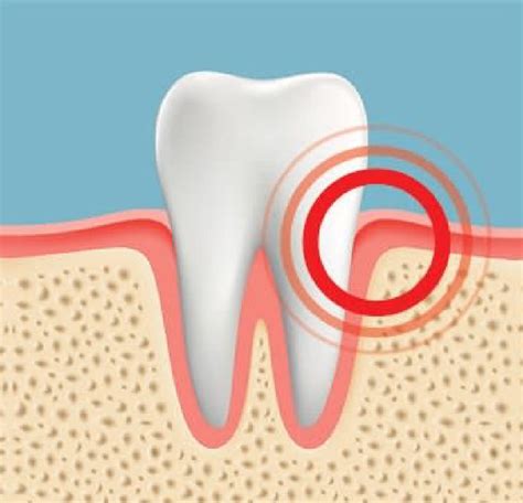 Inflamed Gums: Causes and Treatments for Gum Swelling | Crest