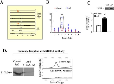 Identification of biomarkers in the CSF of AD cases. For the study, CSF ...