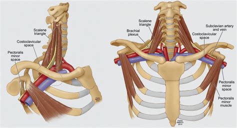 Chiropractic Care Is A Safe And Effective Treatment For Thoracic Outlet