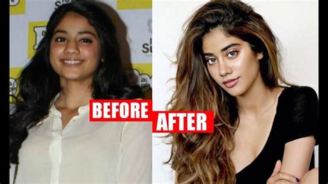 Sridevi Daughter Jhanvi Kapoor Plastic Surgery Before And After Youtube