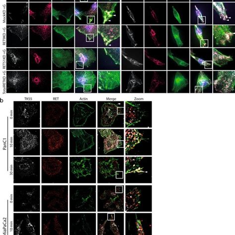 RET Induces Formation Of F Actin And TKS5 Rich Structures A