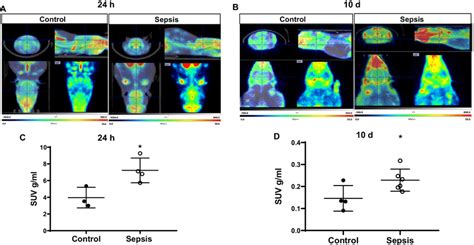 In Vivo Pet Imaging Using Tspo Specific Radiotracer C Pbr