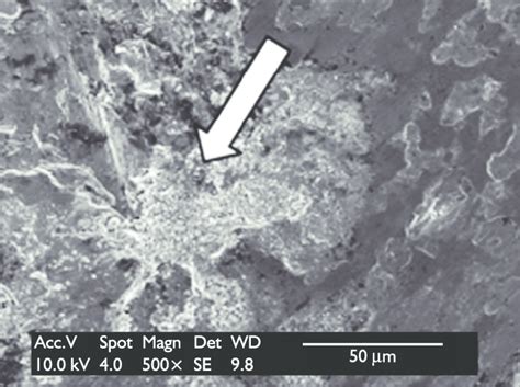 Micrografia Obtida Pela T Cnica De Microscopia Eletr Nica De Varredura