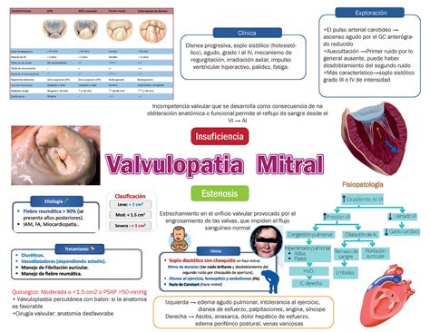 Mitral Mapa Valvulopatia Mitralvalvulopatia Mitralvalvulopatia Mitral