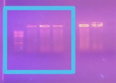 agarose gel electrophoresis showing genomic dna  samples