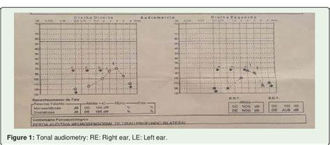 Otosclerosis Audiogram