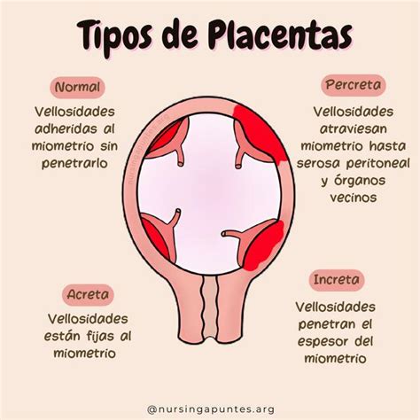 Placentas Enfermería uDocz