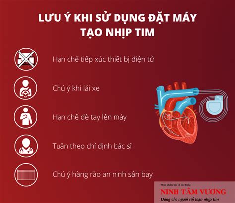 Máy tạo nhịp tim là gì Cần lưu ý gì khi lắp đặt máy tạo nhịp Dịch Vụ