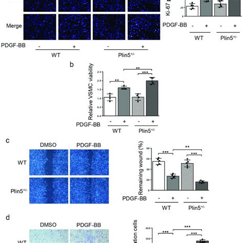 Nac Reverses Elevated Proliferation And Migration Of Vsmc Induced By