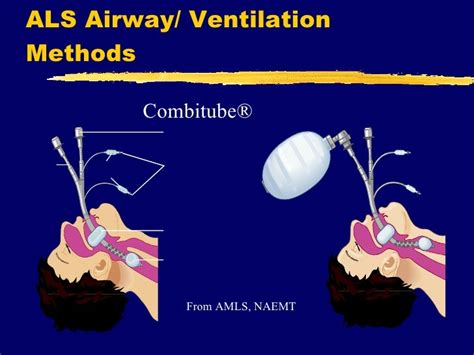 Airway Management 2