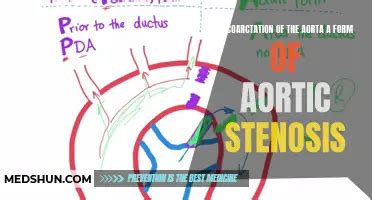 Understanding The Relationship Between A Line And Aortic Stenosis A