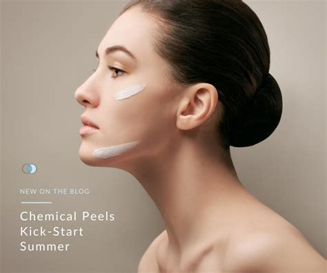 Chemical Peels Kick Start Summer Palo Alto Laser And Skin Care