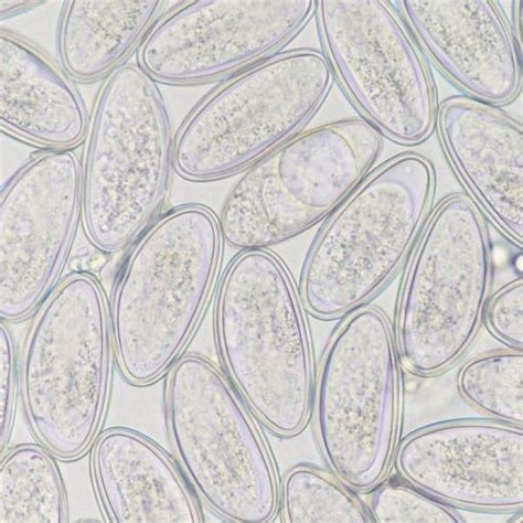 Microscopy Of The Egg Of Enterobius Vermicularis Which Is Approximately Download Scientific