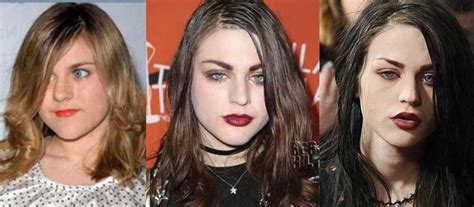 Frances Bean Cobain Plastic Surgery Before And After Pictures 2024