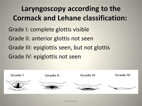 Ppt Airway Management Part Ii Powerpoint Presentation Free