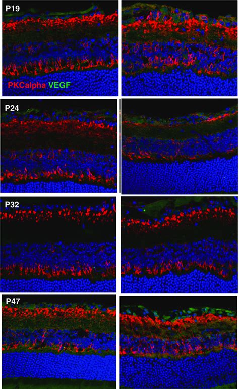 Vegf A 165 Expression And Synaptic Integrity In Ra And Oir Vegfa 165 Download Scientific