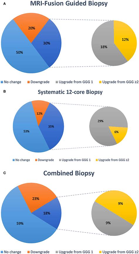 Frontiers Concordance Of Mri Guided Fusion And Systematic 12 Core Prostate Biopsy For The