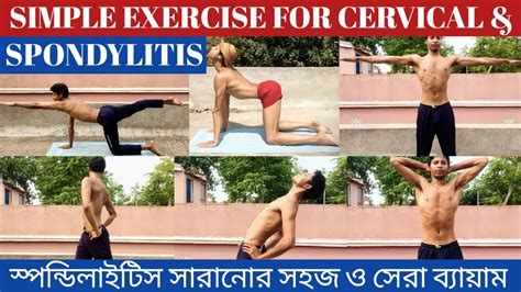 simple excercise for cervical spondylitis সপনডলইটস এর বযযম