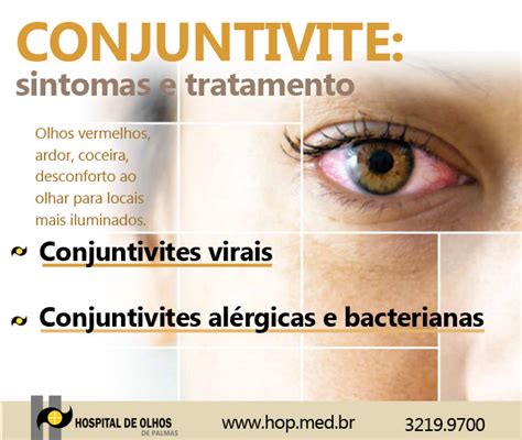 CONJUNTIVITE Sintomas E Tratamento